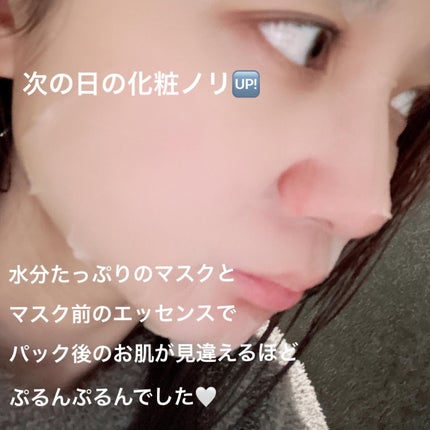 NiCO*フォロバ100 on LIPS 「*PRUMWELLNESSグルタシカ白肌ケアマスクパックXにて..」(4枚目)