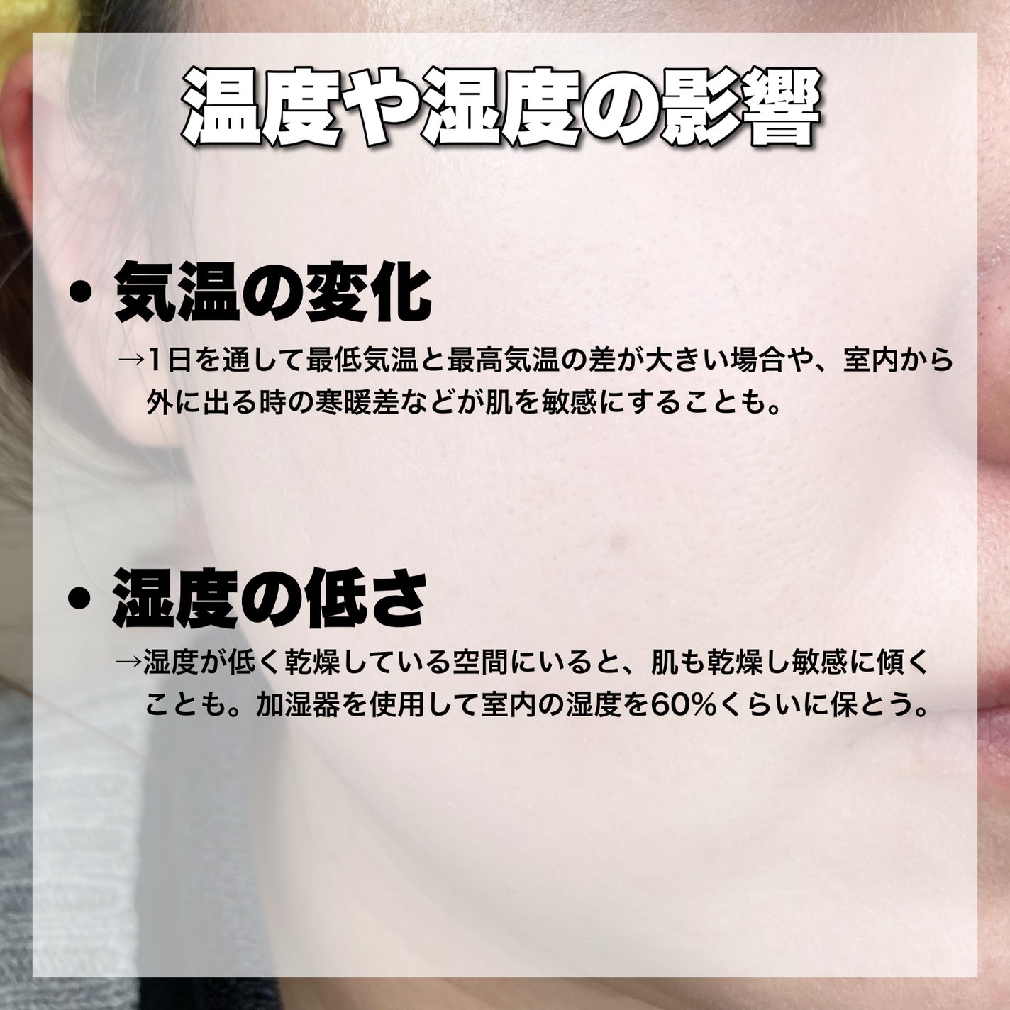 AD コントロール ローション/ACSEINE/化粧水を使ったクチコミ(4枚目)