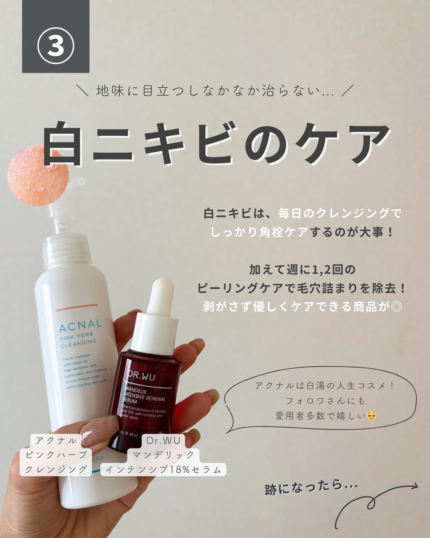 白湯(サユ) | ニキビと戦うOL🤍 on LIPS 「これ見ればOK!ニキビ改善の教科書📕ニキビって一括りにされる..」(5枚目)