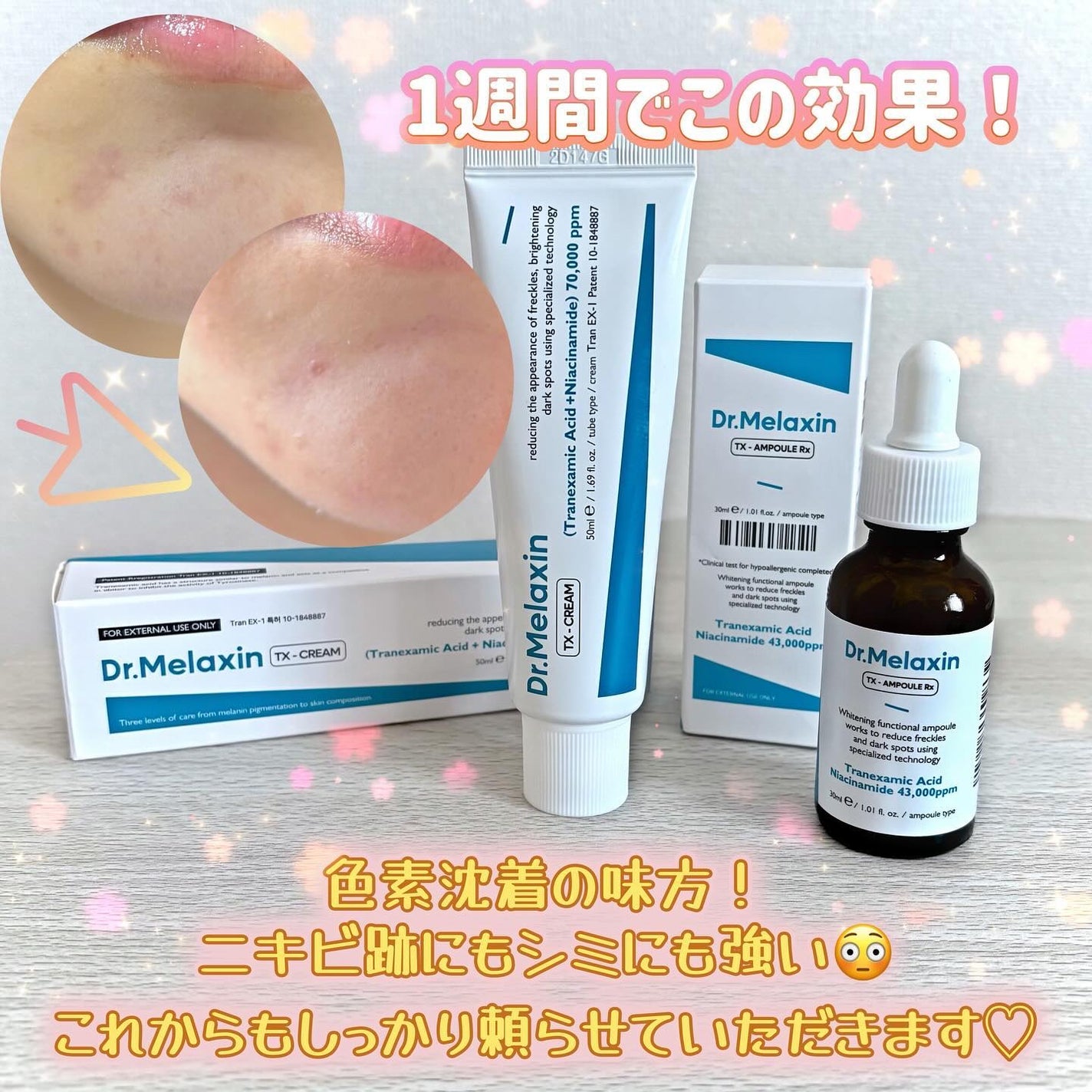 TX-Cream/Dr.Melaxin/フェイスクリームを使ったクチコミ(4枚目)