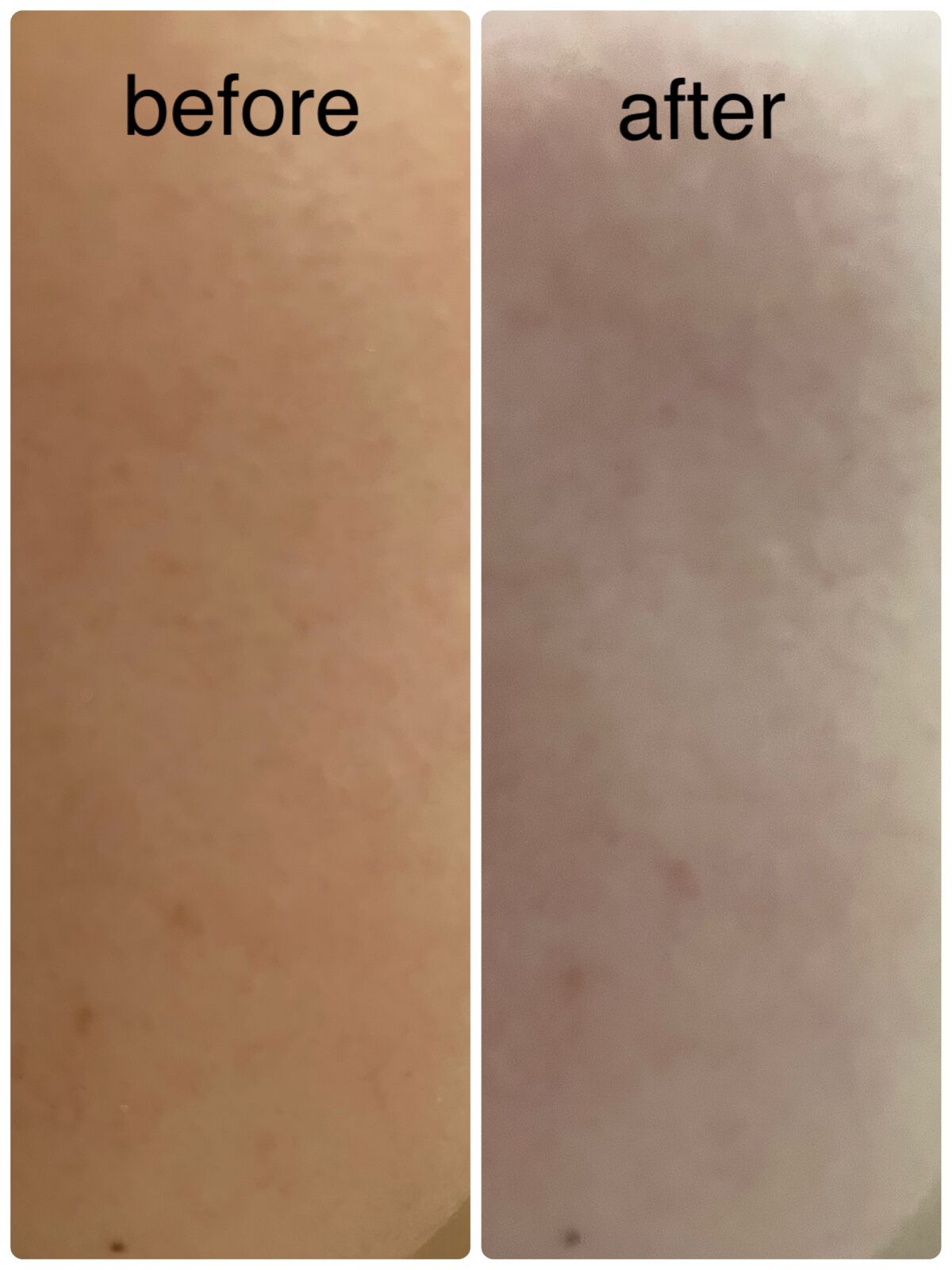 リードルショット100/VT/美容液を使ったクチコミ(2枚目)