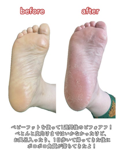 イージーパックDP60分タイプ/ベビーフット/レッグ・フットケアを使ったクチコミ(2枚目)