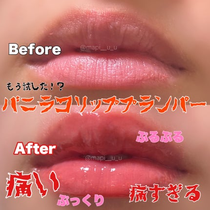 ボリュームリッププランパー|BANILA COの効果に関する口コミ ボリュームリッププランパー|BANILA COの効果に関する口コミ