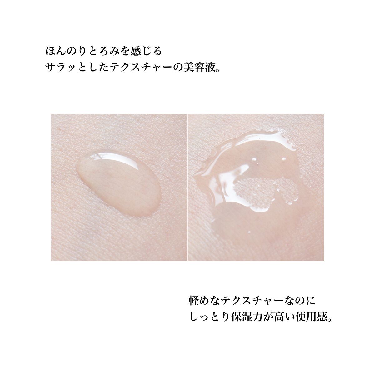 バイタルドロップ/EVERYSKIN/美容液を使ったクチコミ（3枚目）