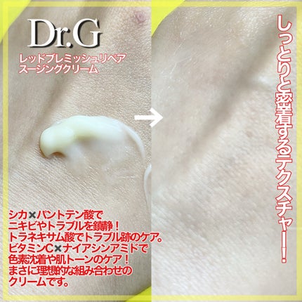 レッドブレミッシュ リペアスージングクリーム/Dr.G/フェイスクリームを使ったクチコミ(3枚目)