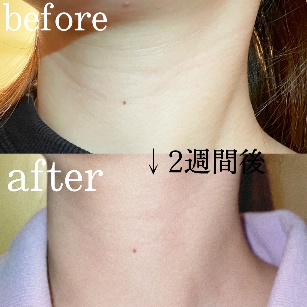 ソイビーンエネルギー　ネッククリーム　EX/innisfree/フェイスクリームを使ったクチコミ（3枚目）