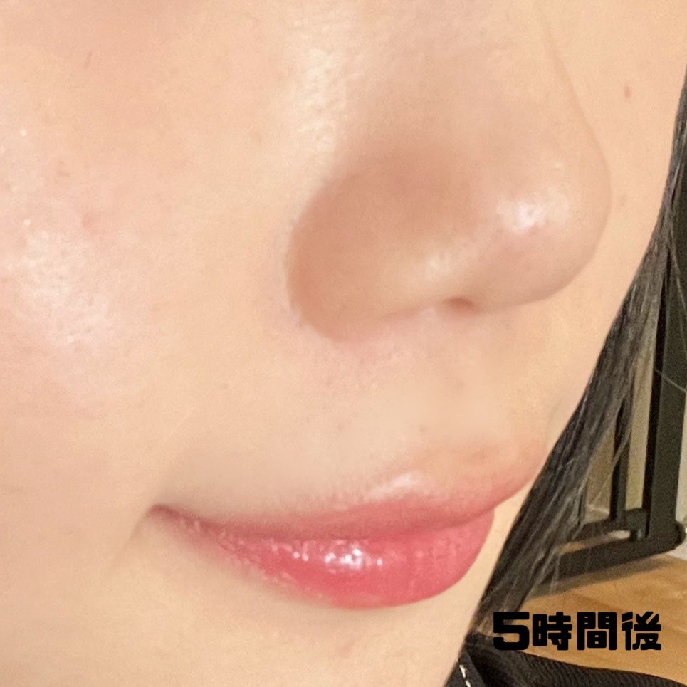 ダーマシンコンシーラー/23years old/リキッドコンシーラーを使ったクチコミ(5枚目)