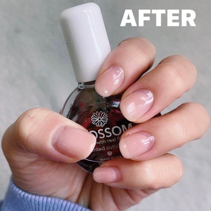 キューティクルオイル/キャンディ ブロッサム/ネイルオイル・トリートメントを使ったクチコミ(5枚目)