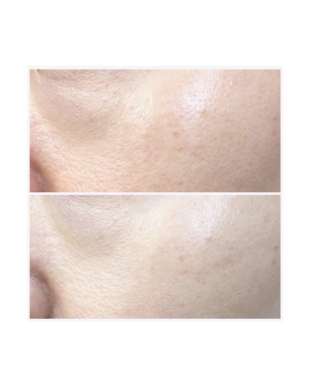 ドラマティックフェイスパウダー/マキアージュ/プレストパウダーを使ったクチコミ(5枚目)