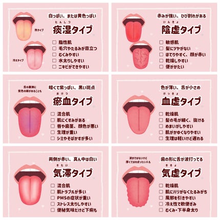 プロポリンス/プロポリンス/マウスウォッシュ・スプレーを使ったクチコミ(8枚目)