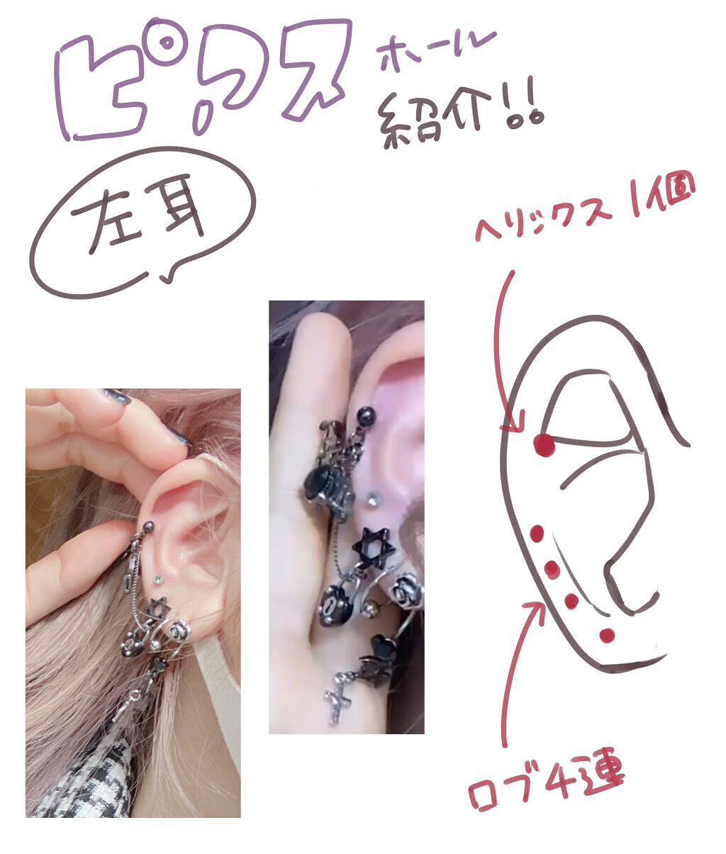 ドルマイシン軟膏(医薬品)/ゼリア新薬工業/その他を使ったクチコミ（2枚目）