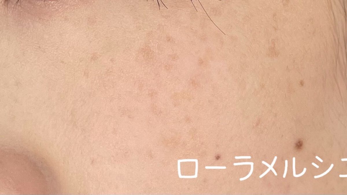 フローレス フュージョン ウルトラ ロングウェア ファンデーション/ローラ メルシエ/リキッドファンデーションを使ったクチコミ（3枚目）