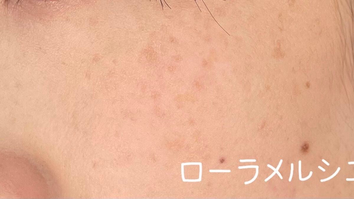 フローレス フュージョン ウルトラ ロングウェア ファンデーション/ローラ メルシエ/リキッドファンデーションを使ったクチコミ(3枚目)