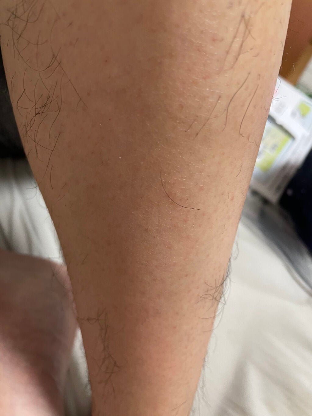 脱毛 ワックスシート/DAISO/除毛クリームを使ったクチコミ(3枚目)