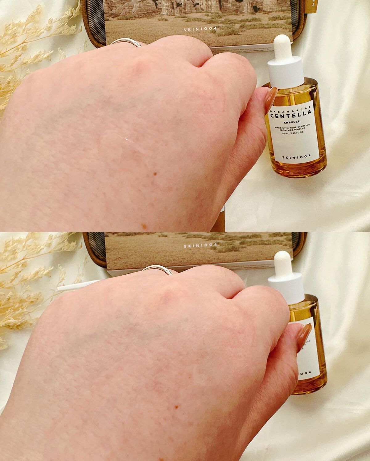 センテラ アンプル/SKIN1004/美容液を使ったクチコミ(5枚目)