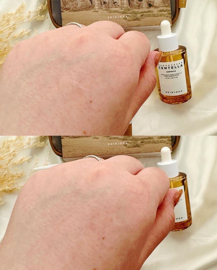 センテラ アンプル/SKIN1004/美容液を使ったクチコミ(5枚目)