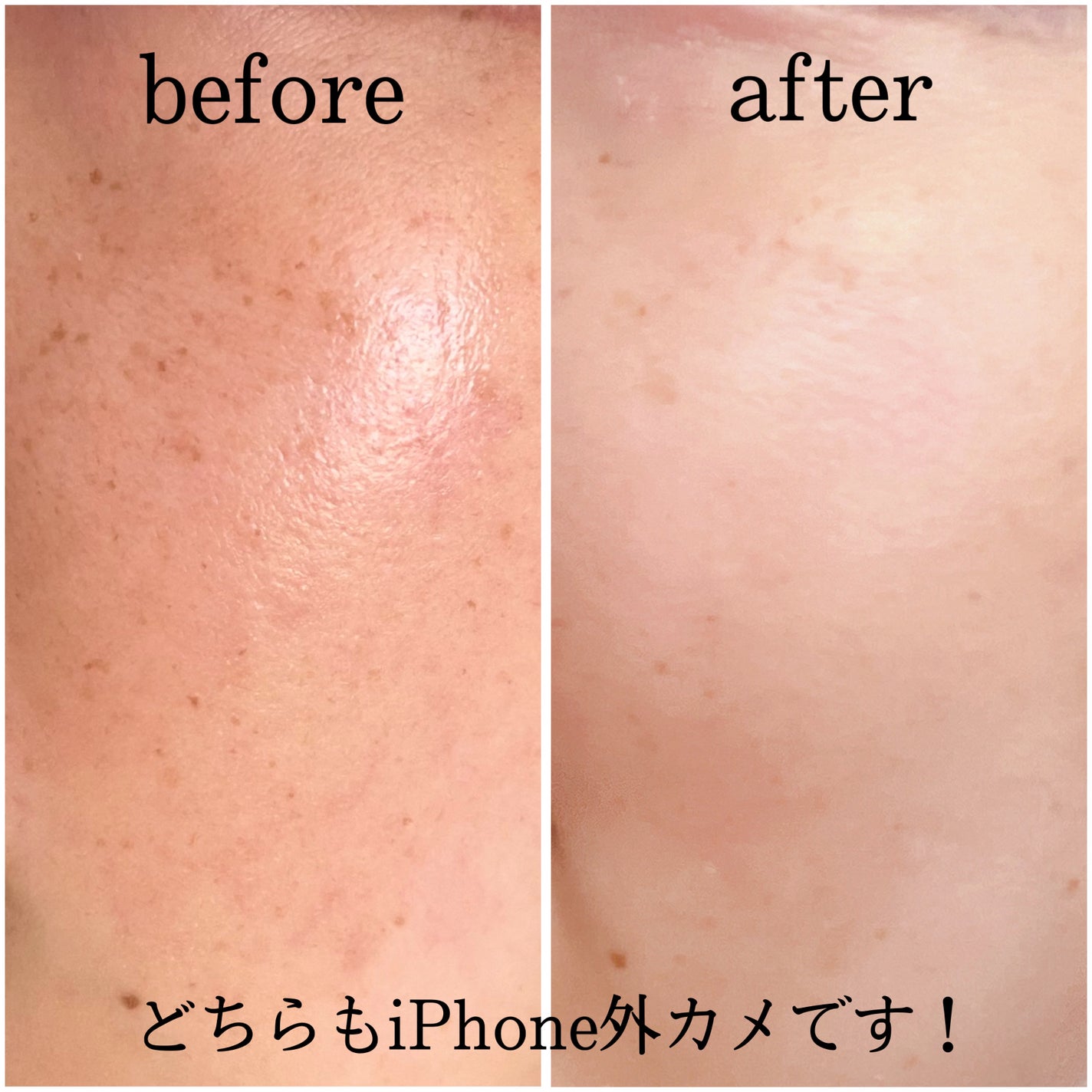 グロウスキンデーション/orin/化粧下地を使ったクチコミ(4枚目)