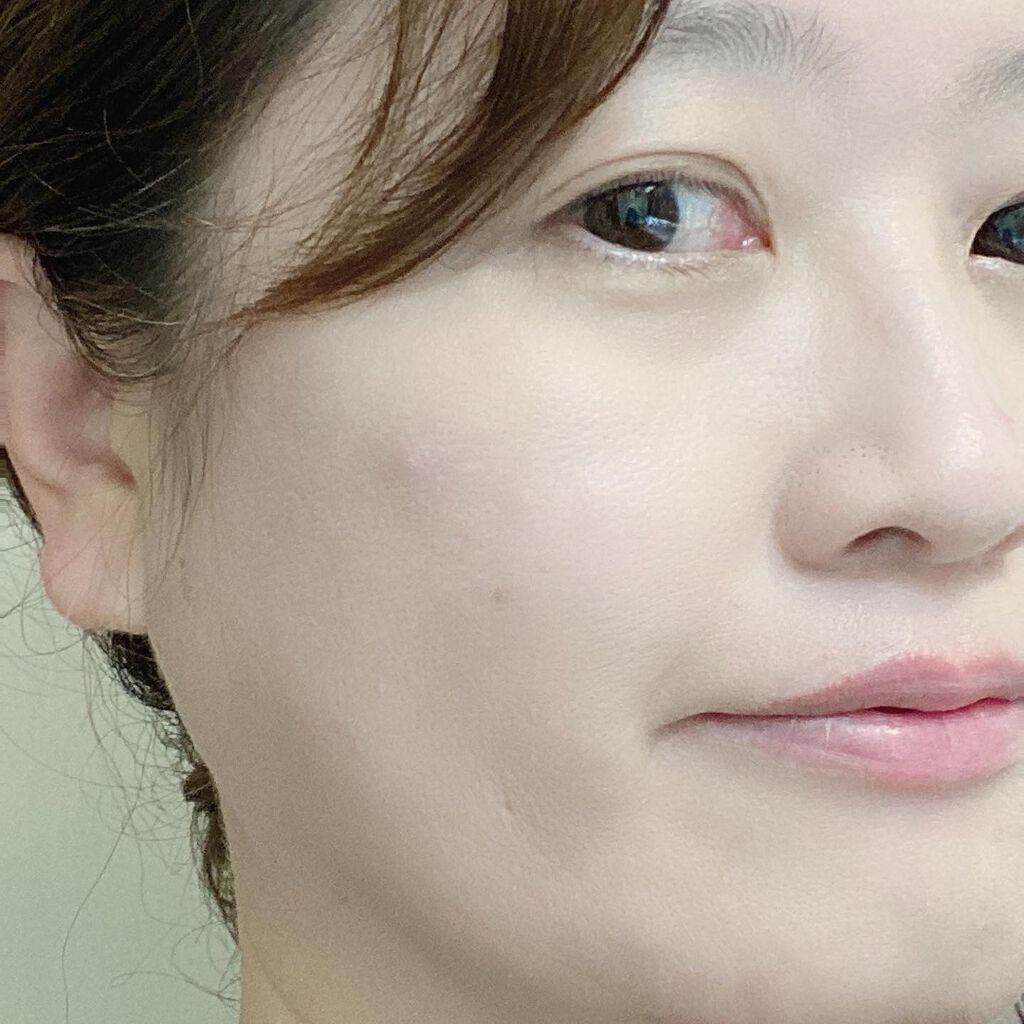 Wエッセンス/shimaboshi/美容液を使ったクチコミ(5枚目)