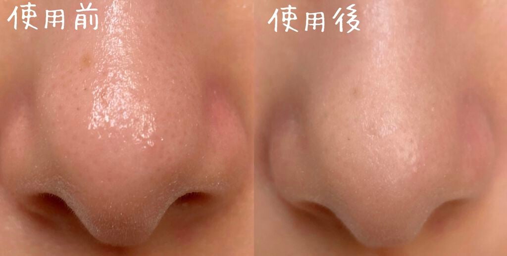 ポアカバー セラムスティック/ettusais/美容液を使ったクチコミ(2枚目)