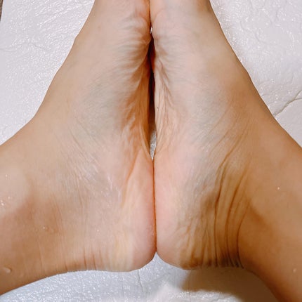 あしやすめ 足裏角質ケアパック/鎌倉ライフ/レッグ・フットケアを使ったクチコミ(7枚目)