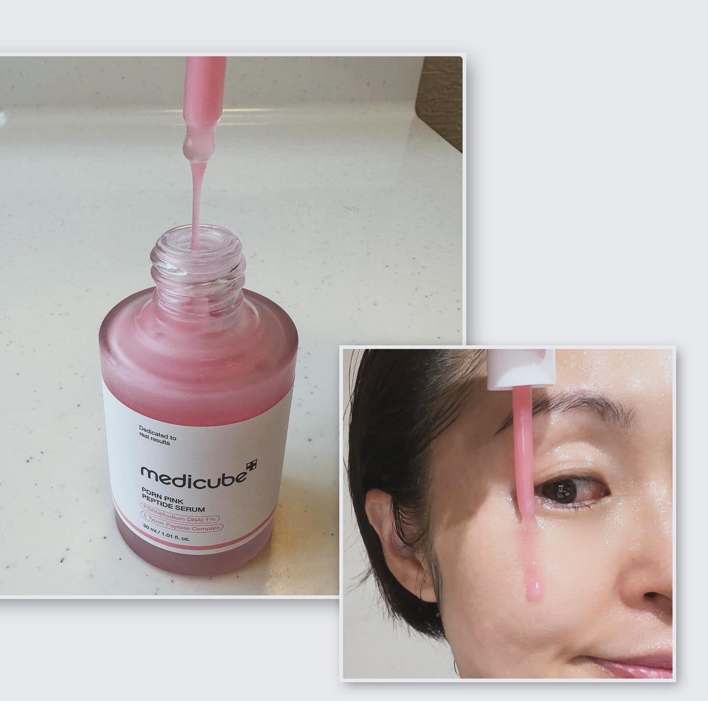 fuzukiフォロバ♡ on LIPS 「おうちで塗るだけサーモン注射♡medicube(メディキューブ..」(3枚目)