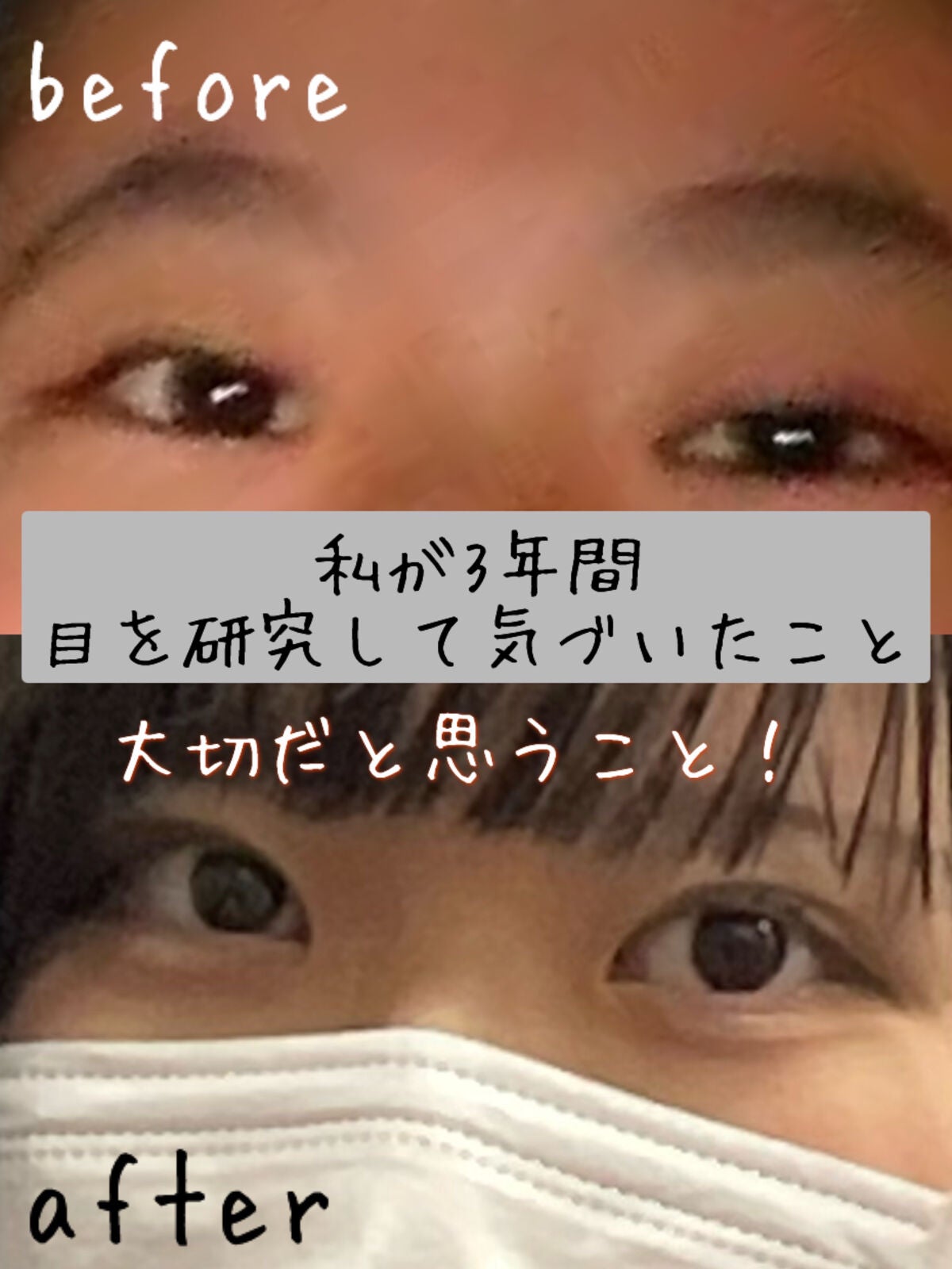 のびーるアイテープ(絆創膏タイプ、レギュラー)/DAISO/二重まぶた用アイテムを使ったクチコミ(1枚目)