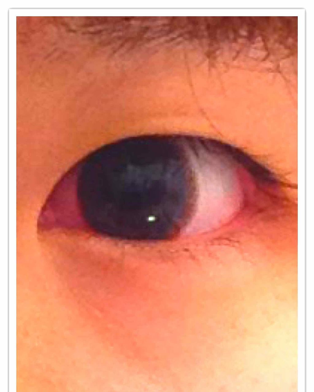 アーティラル ワンデー/ARTIRAL/ワンデー(1DAY)カラコンを使ったクチコミ(2枚目)