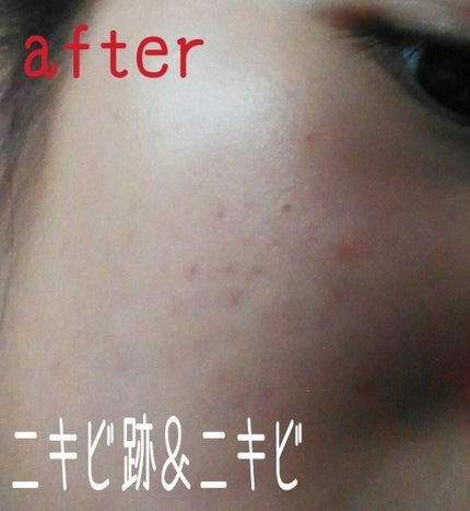 ハトムギ化粧水(ナチュリエ スキンコンディショナー R )/ナチュリエ/化粧水を使ったクチコミ(2枚目)