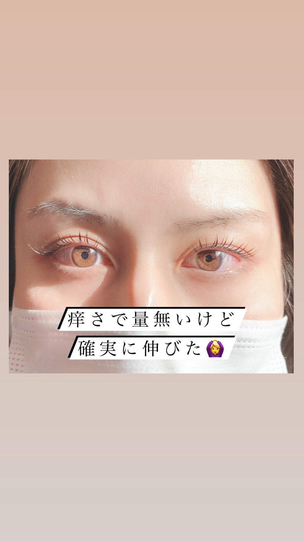 ラッシュアディクト アイラッシュコンディショニングセラム/soaddicted/まつげ美容液を使ったクチコミ(3枚目)