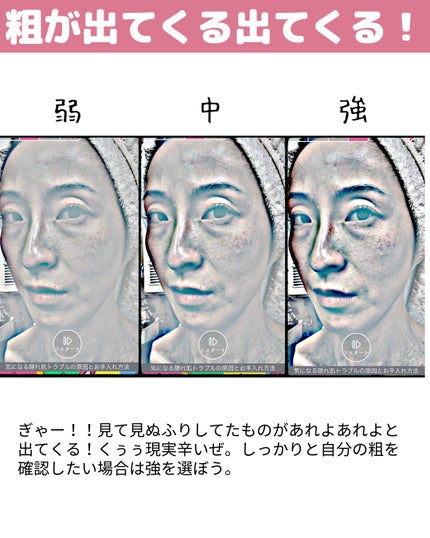 miisa/歳を重ねても"可愛い"をつくる美容法 on LIPS 「\衝撃/自分の肌と向き合う覚悟はできているか🫵𓇠𓇠𓇠𓇠𓇠𓇠𓇠𓇠..」(4枚目)