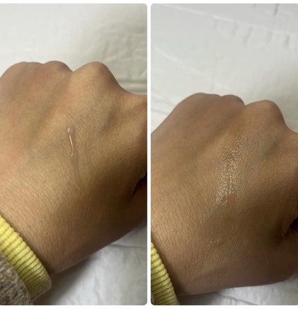 ビトック フォー デイリー RX/Differ&Deeper/美容液を使ったクチコミ(4枚目)