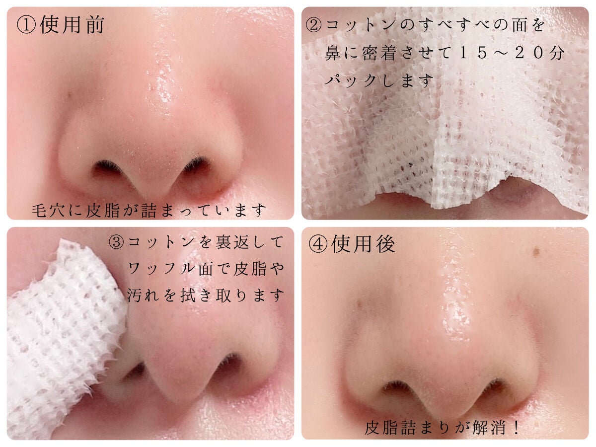 ヘルプミー! ダクトパッド/One-day's you/トナーパッドを使ったクチコミ(9枚目)