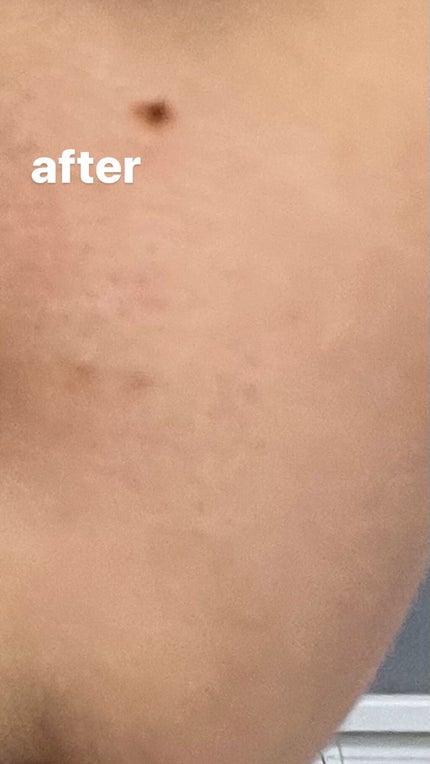 ワフードメイド 酒粕パック/pdc/洗い流すパック・マスクを使ったクチコミ(5枚目)