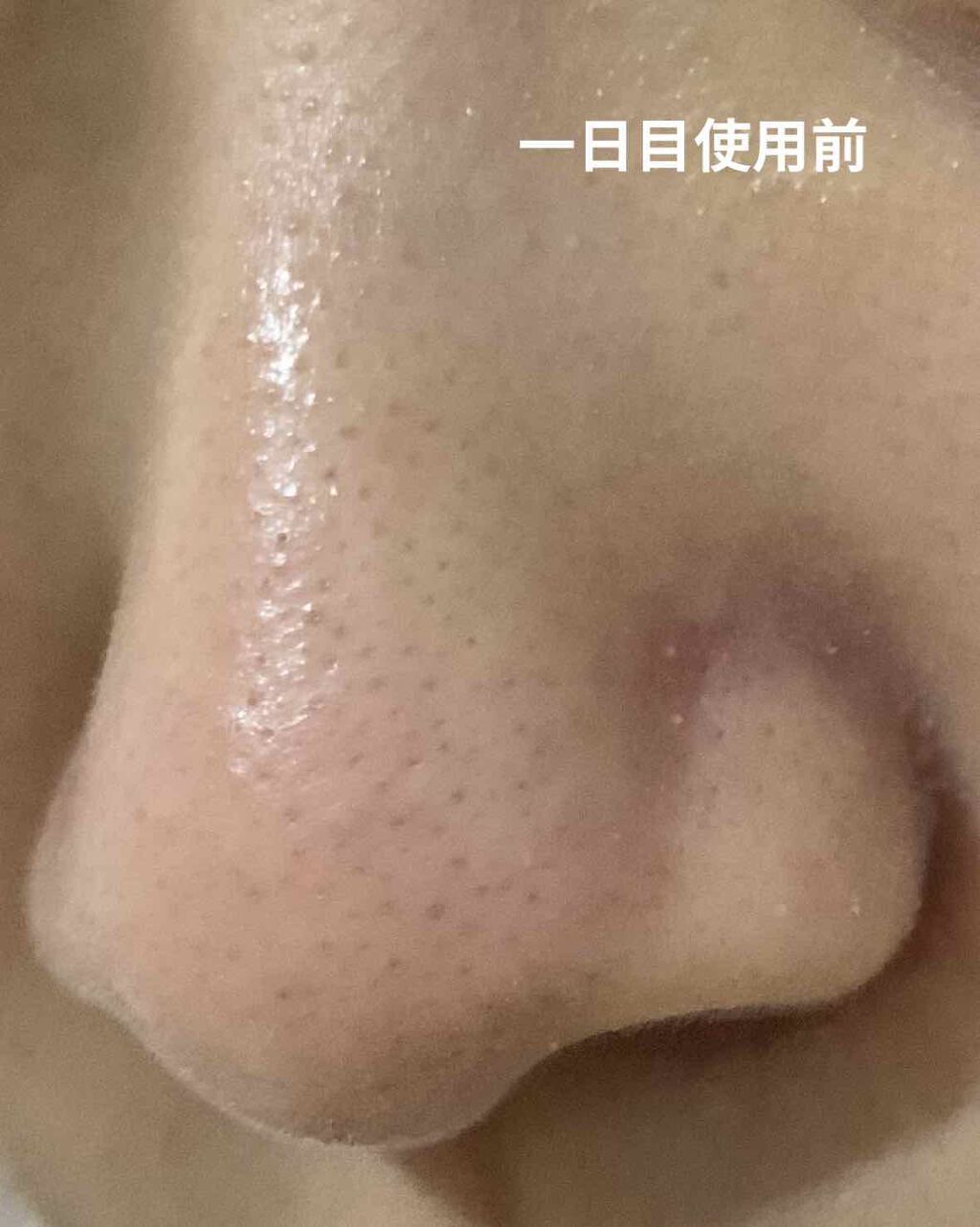 小鼻つるりんクリームパック/毛穴撫子/洗い流すパック・マスクを使ったクチコミ(2枚目)