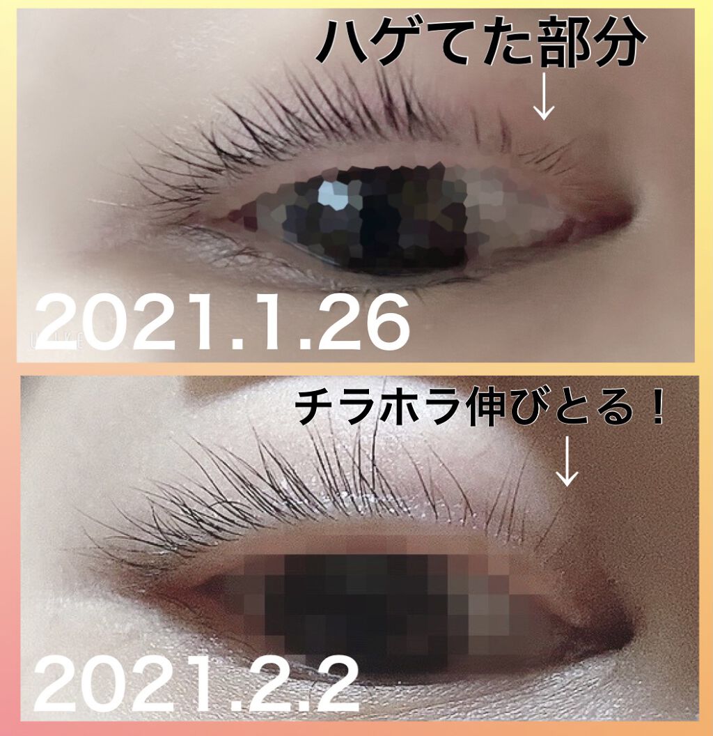 を使ったクチコミ（3枚目）