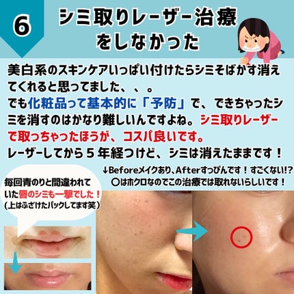 めがねちゃん👓フォロバ on LIPS 「今回は、33年生きた私が美容で後悔していることご紹介します。同..」(8枚目)
