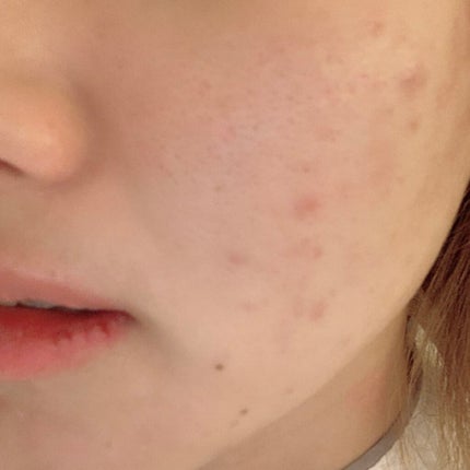 Rエッセンス/unlabel/美容液を使ったクチコミ(4枚目)