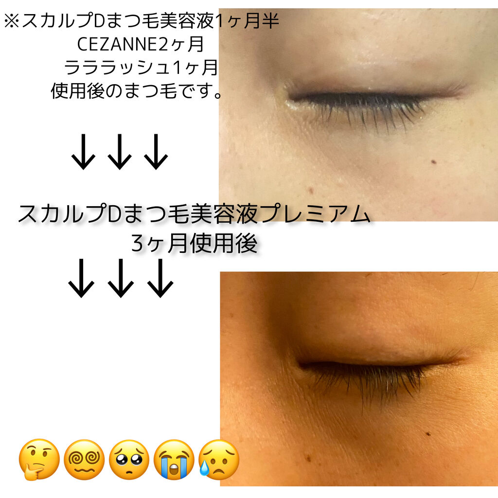 スカルプD ボーテ ピュアフリーアイラッシュセラム　プレミアム/アンファー(スカルプD)/まつげ美容液を使ったクチコミ（3枚目）
