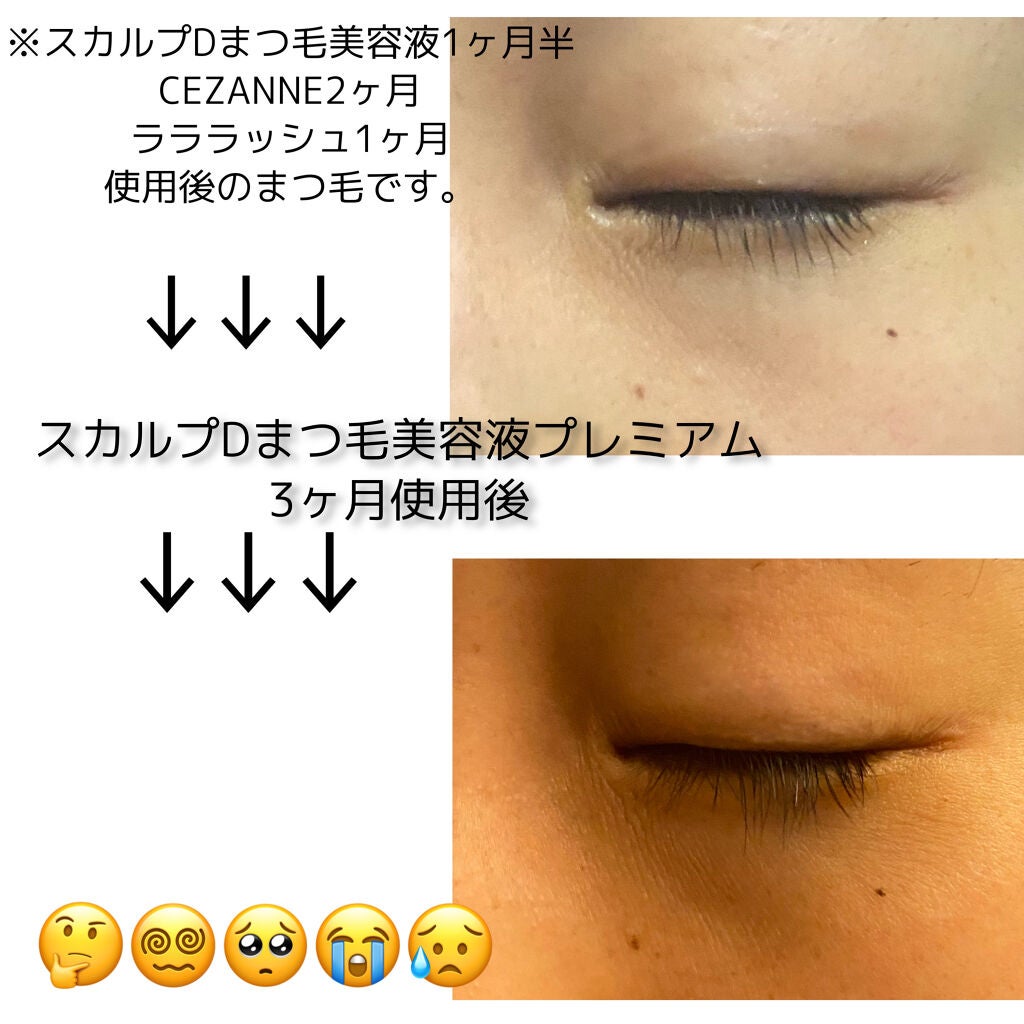 スカルプD ボーテ ピュアフリーアイラッシュセラム プレミアム/アンファー(スカルプD)/まつげ美容液を使ったクチコミ(3枚目)