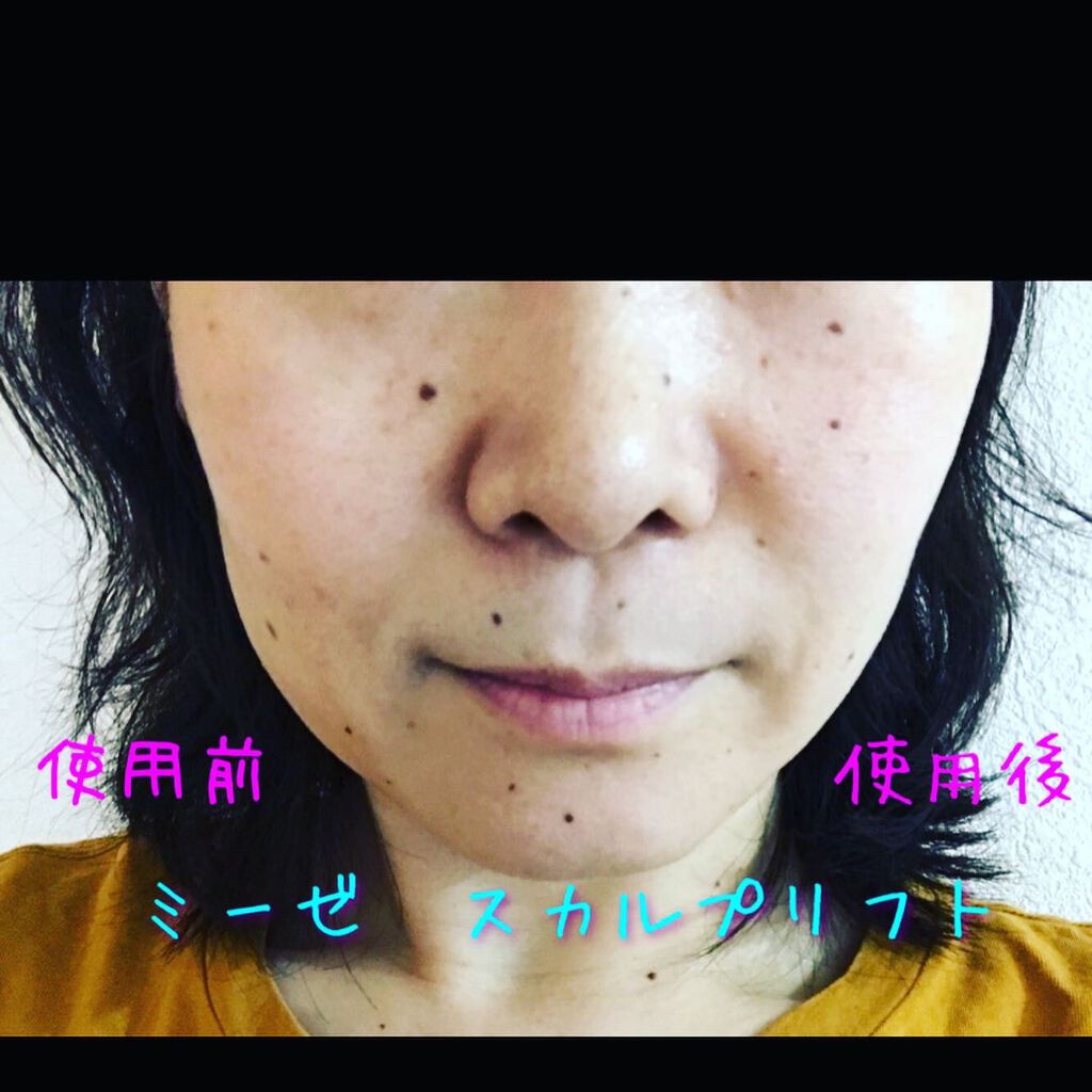 スカルプリフト/mysé(ミーゼ)/ヘアケアグッズを使ったクチコミ(1枚目)