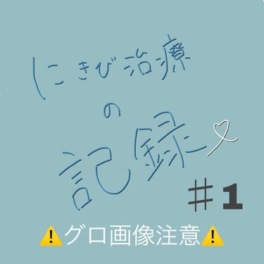 メラノCC 薬用しみ対策 美白化粧水のクチコミ「初投稿です…お見苦しくて申し訳ありません💦
現在大学生なのですが、小学校の頃からずーーっとニキ.....」（1枚目）