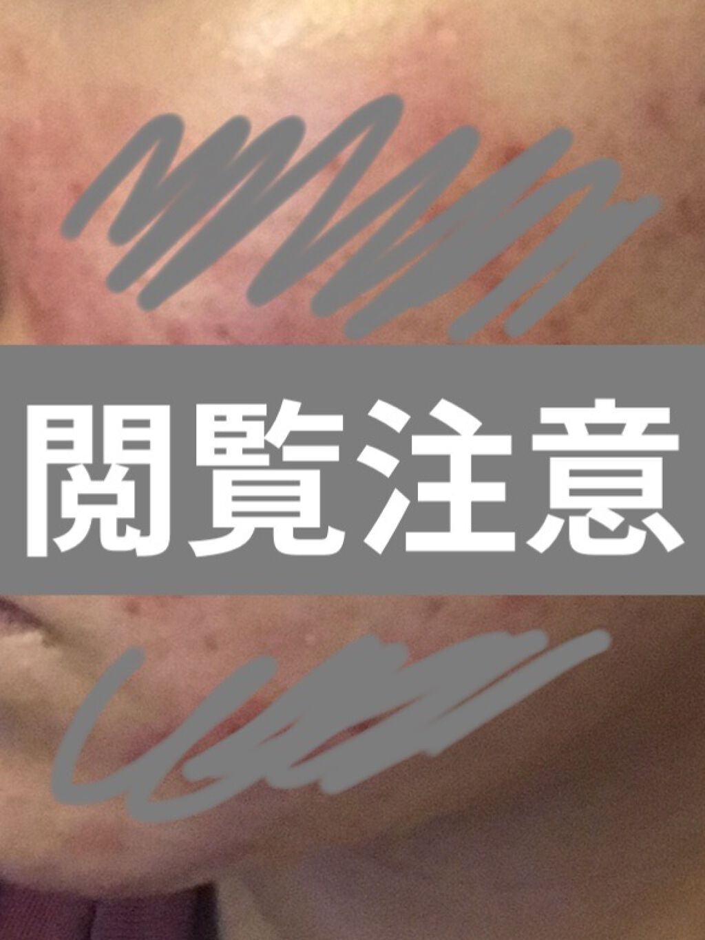 敏感肌用薬用美白美容液/無印良品/美容液を使ったクチコミ（1枚目）