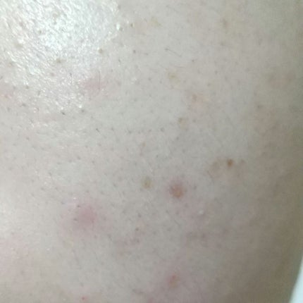 Liu on LIPS 「こんにちは🍒今回が初投稿なのでまだよく分かりませんが助けて頂け..」(3枚目)