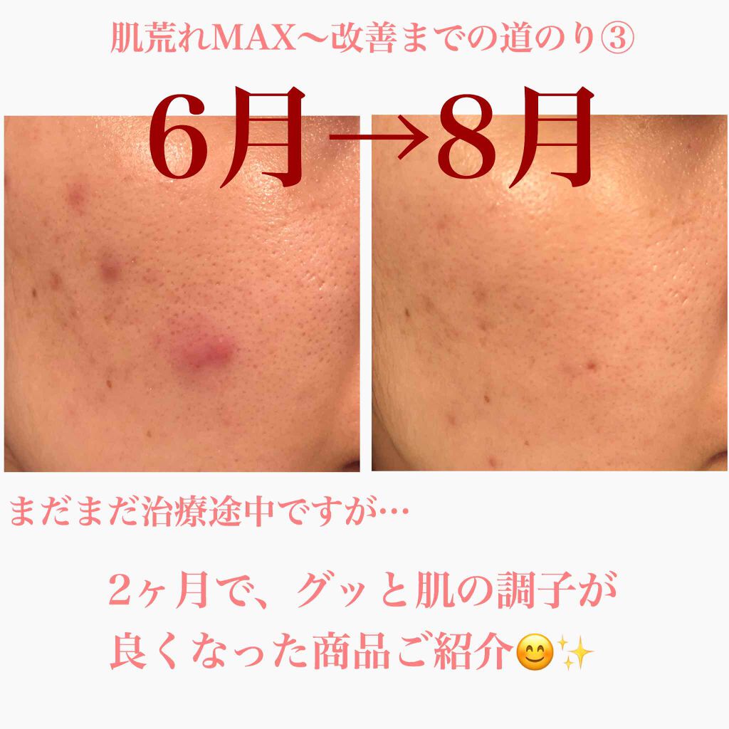 モイスチャージェル1|エンビロンを使った口コミ 「こんにちは ...
