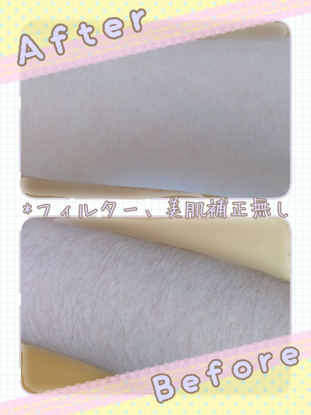 除毛クリームキット敏感肌用/エピラット/除毛クリームを使ったクチコミ(2枚目)