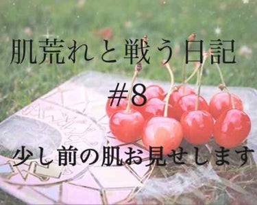 オードムーゲ 薬用保湿化粧水のクチコミ「肌荒れと戦う日記#8 です🎉

⚠️⚠️⚠️3枚目、4枚目、汚い肌注意⚠️⚠️⚠️

今回は、.....」（1枚目）