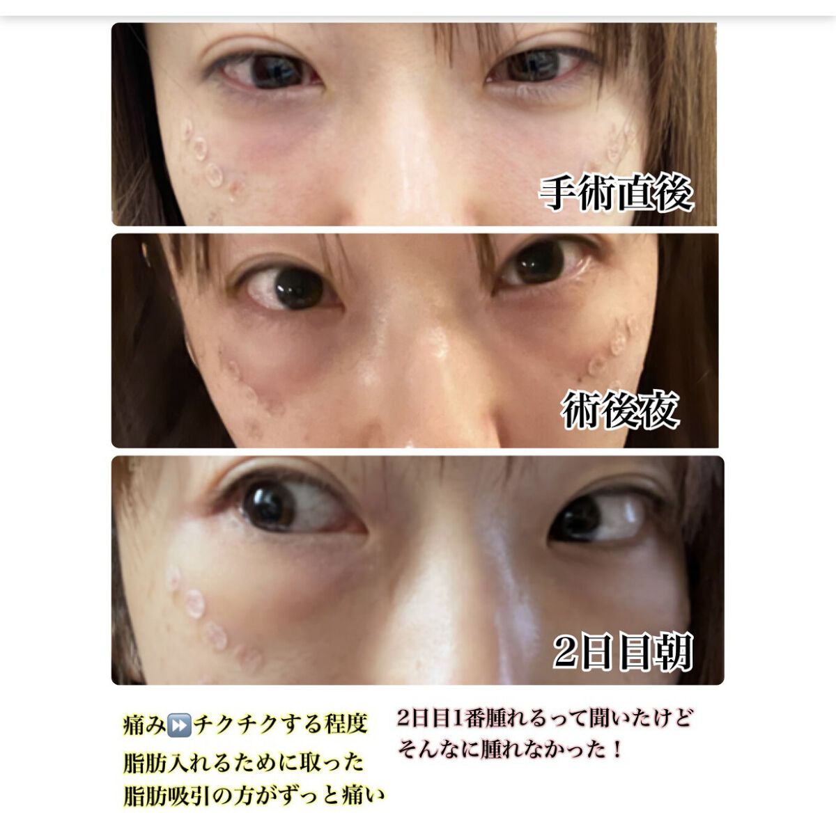 ディエム クルール カラーブレンドパウダーコンシーラー/ディエム クルール/パウダーコンシーラーを使ったクチコミ（2枚目）