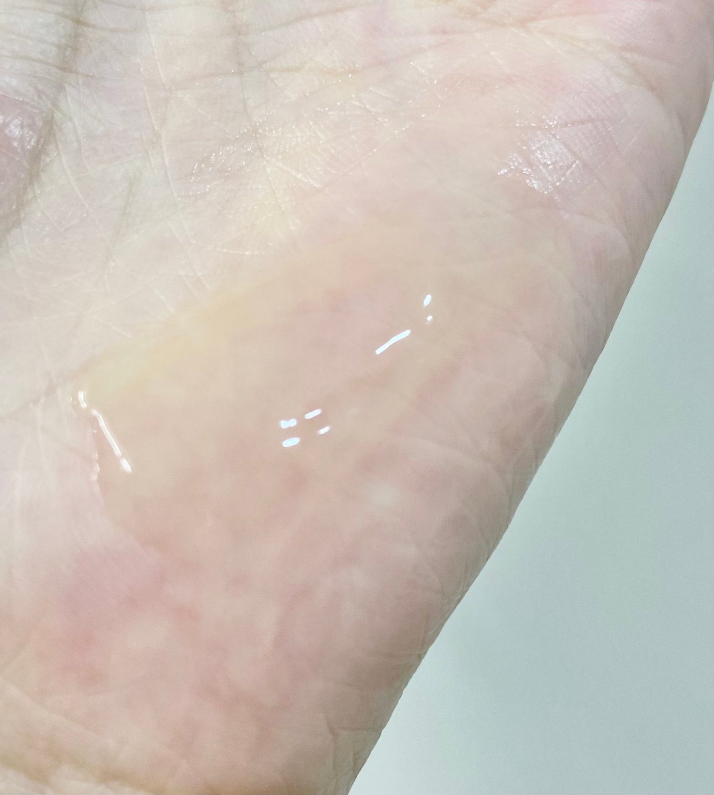 360度ショットPDRNアクティブセラム/センテリアン24/美容液を使ったクチコミ(2枚目)