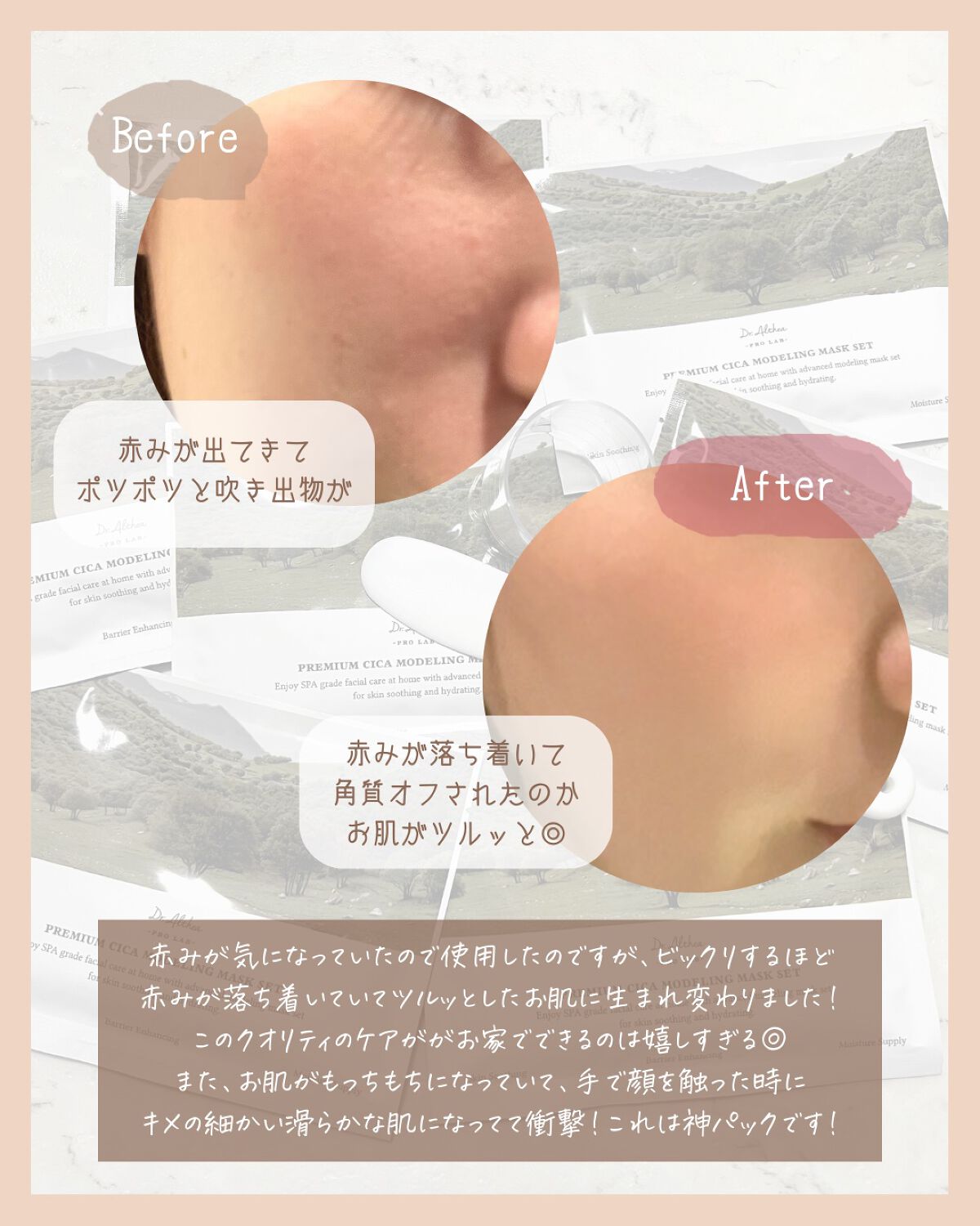 147バリアクリーム/Dr.Althea/フェイスクリームを使ったクチコミ(4枚目)