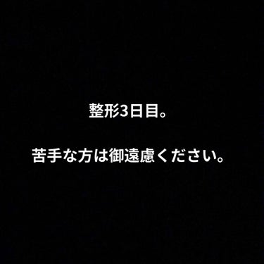 整形3日目。

だいぶ腫れが落ち着いてる✩.*˚

